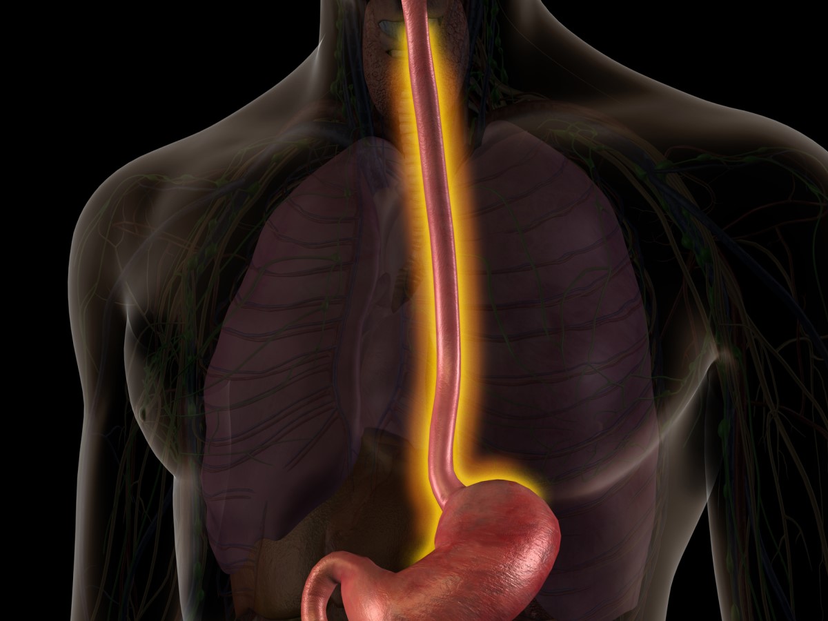 GERD - choroba obejmująca przełyk i żołądek. Ważne jest, aby wykryć źródło problemu. Zdjęcie źródłowe: Getty Images Anatomiczny widok przełyku - przełyk zaznaczony na pomarańczowo.