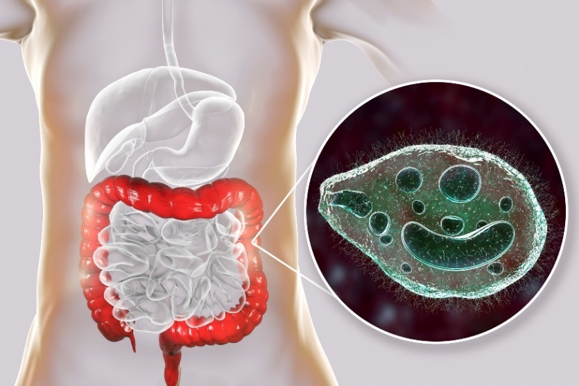 Balantidium coli - pasożyt infekujący jelito grube przewodu pokarmowego człowieka.