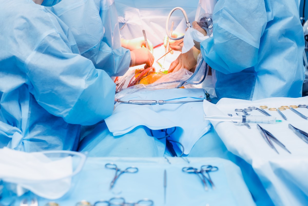 Leczenie chirurgiczne - operacja jako jedna z opcji. Źródło zdjęcia: Getty Images Leczenie chirurgiczne - operacja jamy brzusznej, a lekarze i ratownicy medyczni na sali operacyjnej operują pacjenta.