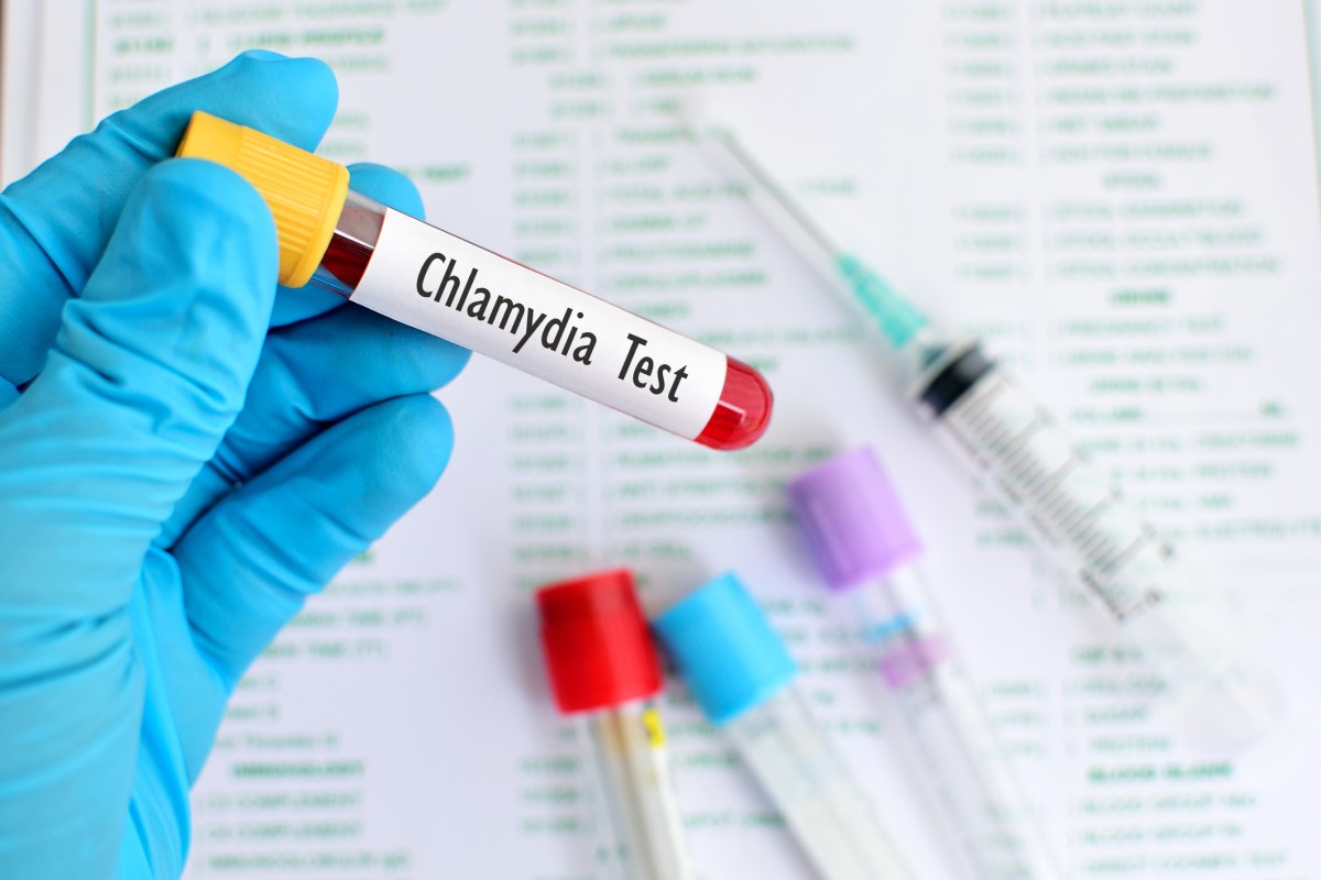 Obecnie istnieje kilka rodzajów testów do wykrywania zakażeń chlamydiami. Najczęściej stosowanym jest test PCR. Źródło: Getty Images Test na chlamydię - krew w probówce, dłoń w rękawiczce trzymająca probówkę, probówka w tle, igła