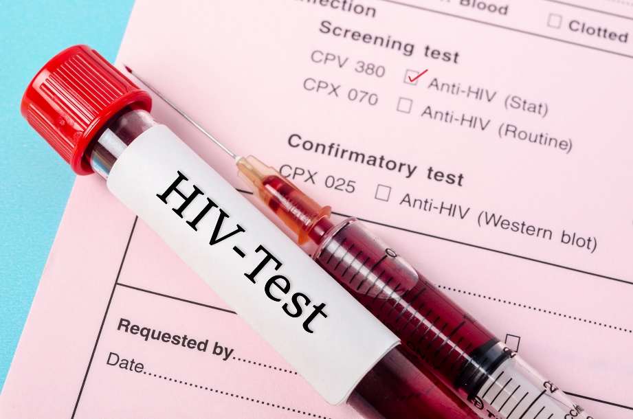 Test diagnostyczny na obecność przeciwciał anty-HIV w próbce krwi pacjenta. Źródło: Getty Images Test diagnostyczny na obecność przeciwciał anty-HIV w próbce krwi pacjenta
