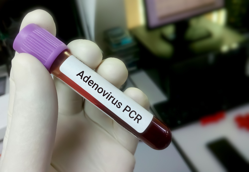 Diagnoza obecności wirusa z próbki krwi pacjenta