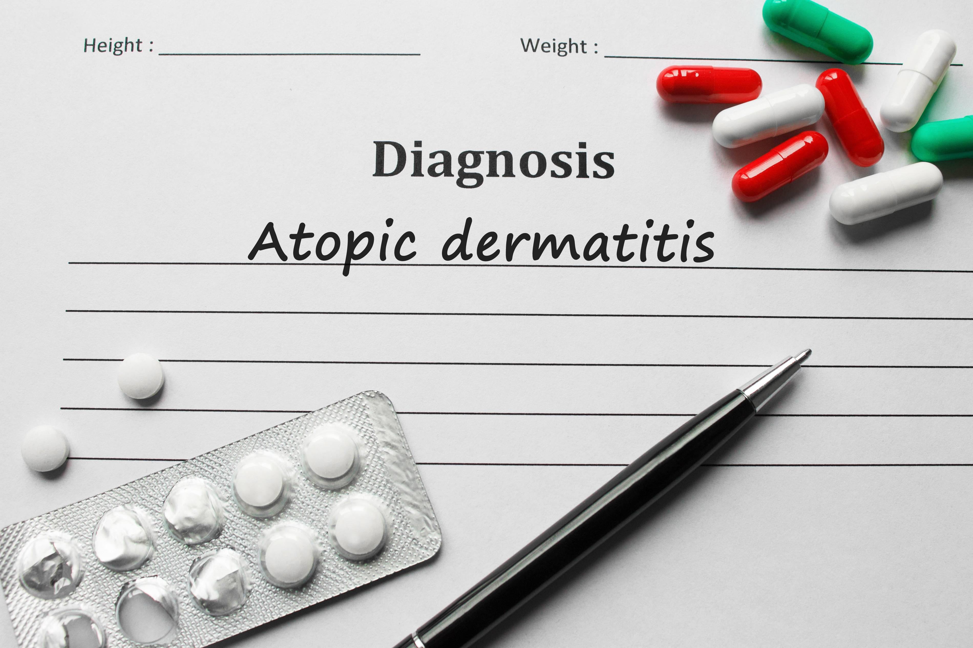 Diagnoza atopowego zapalenia skóry. Źródło: Getty Images Diagnoza atopowego zapalenia skóry
