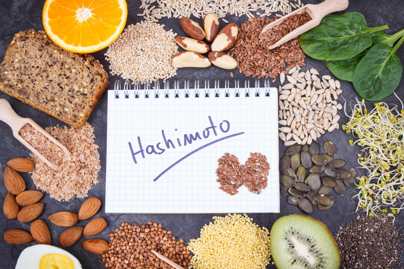 Zapalenie tarczycy Hashimoto i odpowiednia dieta. Źródło zdjęcia: Getty Images Zapalenie tarczycy Hashimoto i odpowiednia dieta