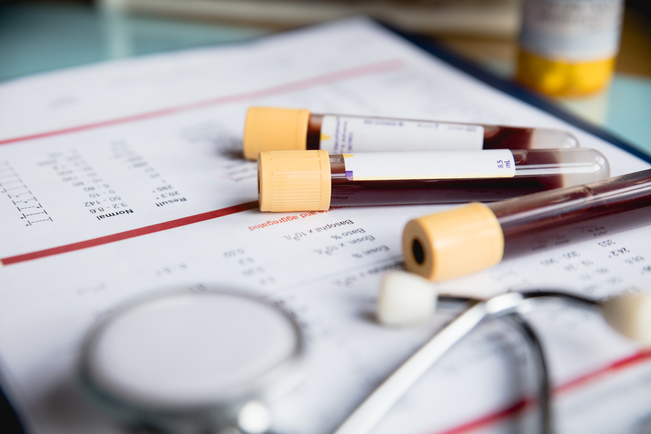 Jedną z najczęstszych metod diagnostycznych w celu określenia niedoboru witamin są badania krwi. Źródło: Getty Images Badania krwi