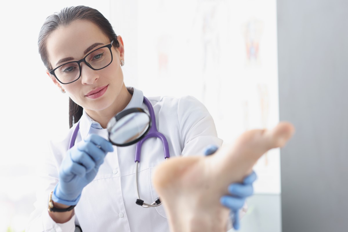 Ważne jest, aby poddać się profesjonalnemu badaniu w celu ustalenia prawidłowej przyczyny i diagnozy. Źródło: Getty Images Badanie skóry stopy przez lekarza przy użyciu szkła powiększającego.