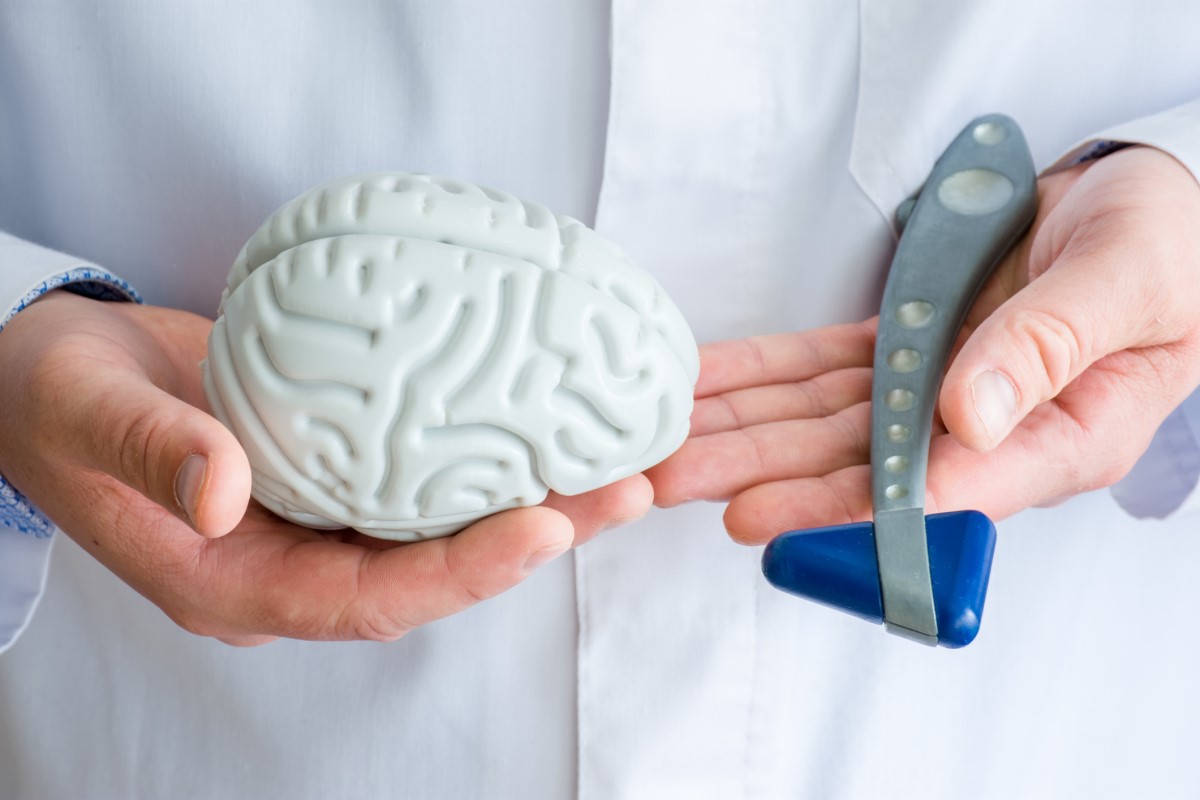 Wczesna diagnoza jest ważna. Źródło: Getty Images Badanie przez neurologa, lekarz trzyma model mózgu i badanie neurologiczne młotkiem.