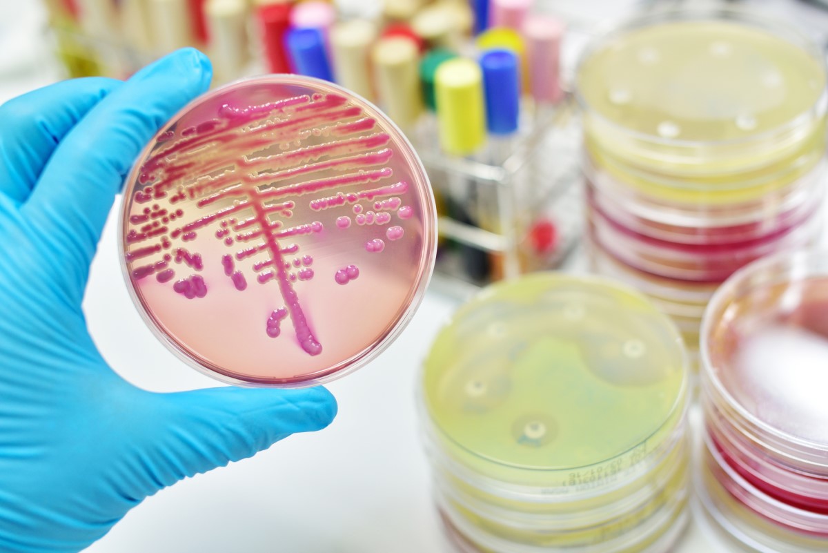 Kolonie bakterii - podczas badania mikrobiologicznego Źródło: Getty Images Badanie mikrobiologiczne - hodowla - kolonie bakterii