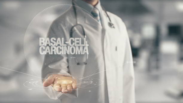 Śmiertelność (wskaźnik zgonów) z powodu BCC jest bardzo niska