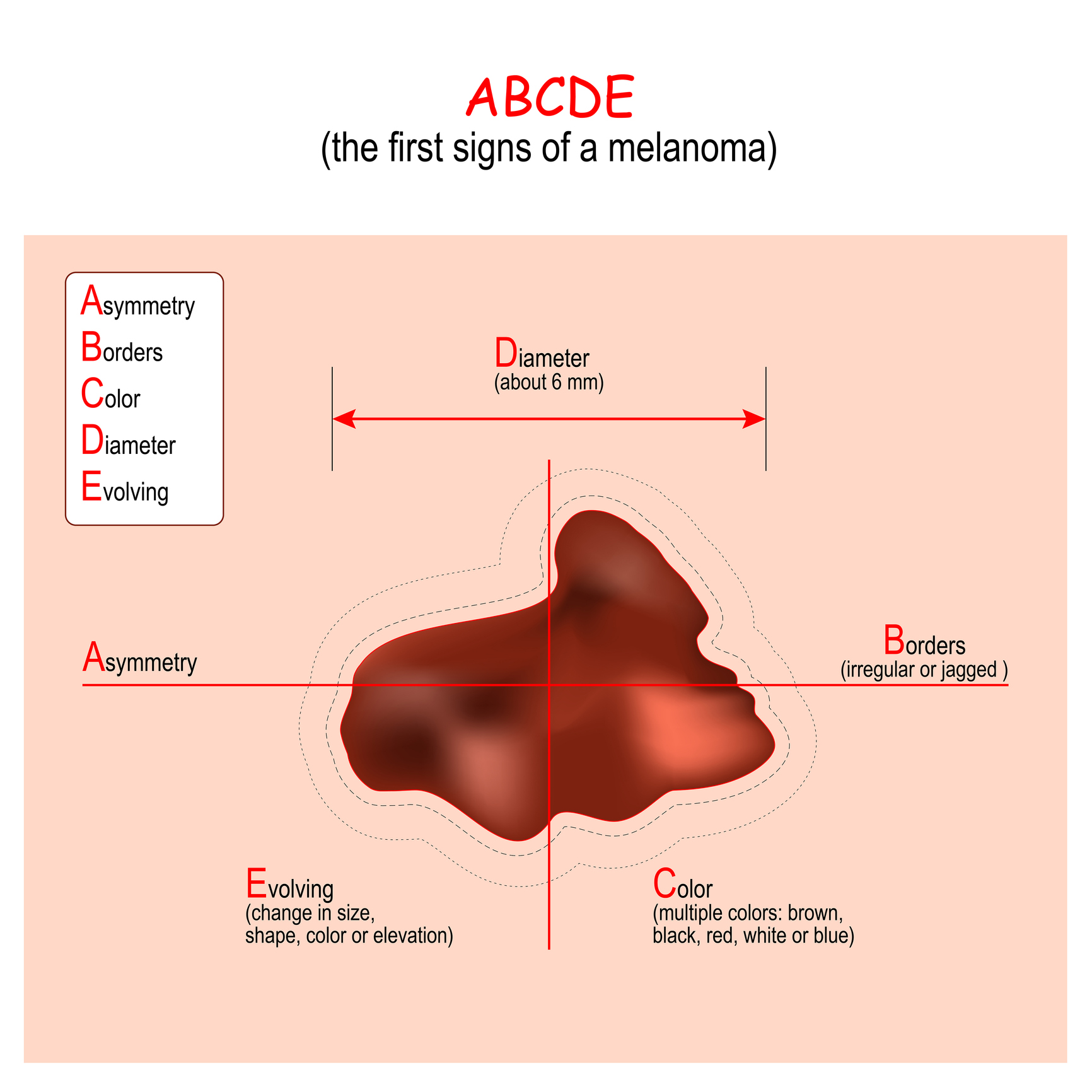 Algorytm ABCDE Źródło: Getty Images Algorytm ABCDE