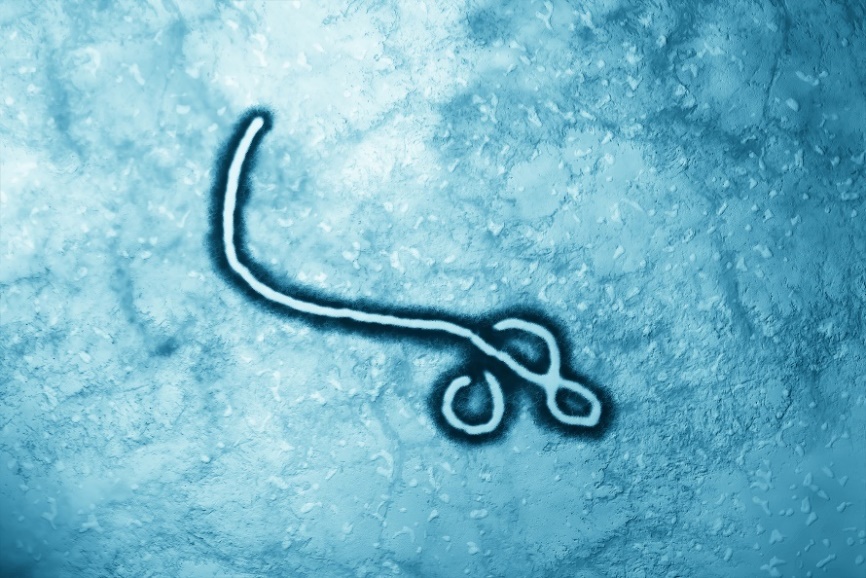 Wirus Ebola pod mikroskopem Źródło: Getty Images Wirus Ebola pod mikroskopem
