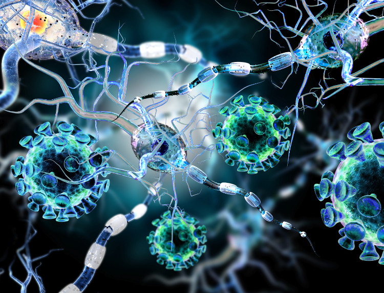 Choroby autoimmunologiczne, na zdjęciu neurony Źródło: thinkstock photo mikroskopijna reprezentacja komórek układu nerwowego neuronów