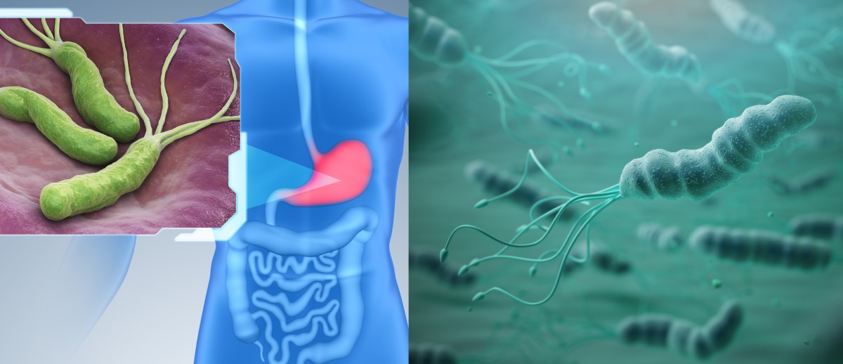 Helicobacter pylori kolonizuje wyściółkę żołądka i jest czynnikiem ryzyka zapalenia żołądka, choroby wrzodowej i raka.