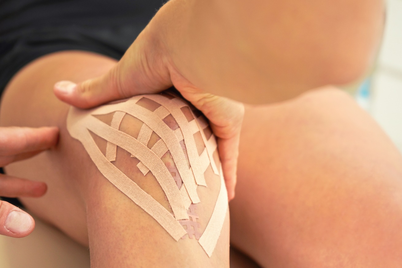 Kinesiotaping limfatyczny (lymphotape) stosowany w okolicy stawu kolanowego. Źródło: Getty Images Kinesiotaping limfatyczny (lymphotape) stosowany w okolicy stawu kolanowego