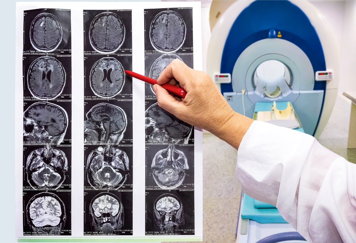 Badanie radiologiczne Źródło: Getty Images Badanie radiologiczne