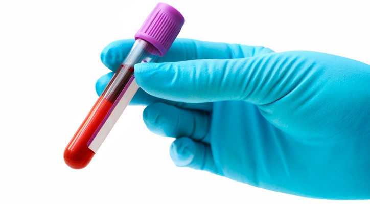 Ważne jest również biochemiczne badanie krwi. Źródło: Getty Images Badanie krwi, krew w probówce, niebieska rękawiczka na dłoni