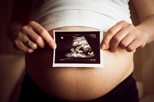 Okres prenatalny Fot: Getty Images Kobieta w ciąży trzymająca sonogram ze zdjęciem dziecka
