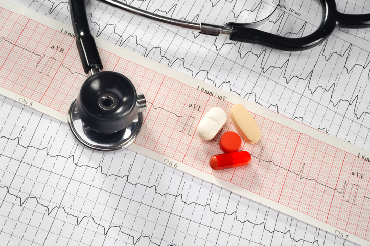 Zapis EKG jest niezwykle ważny i decydujący. Zdjęcie: Getty Images Zapis EKG za pomocą fonendoskopu i leków