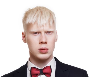 młody albinos, białe włosy, ubrany w kurtkę