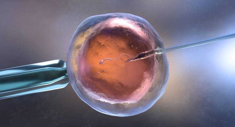 Zapłodnienie in vitro IVF. Źródło: Getty Images