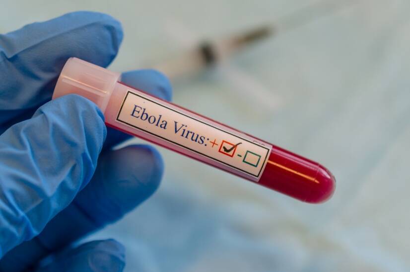 Ebola: Jakie są objawy?