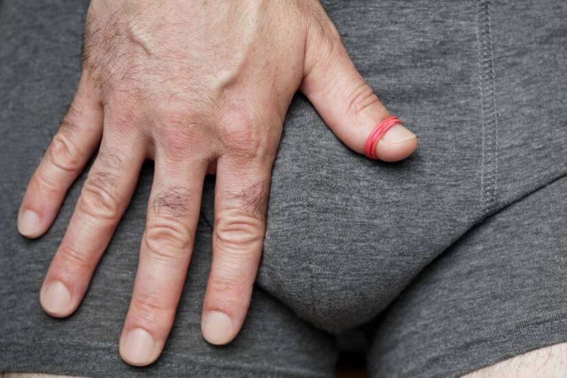 Stulejka i parafimoza (zwężenie napletka): jakie są jej przyczyny i objawy?
