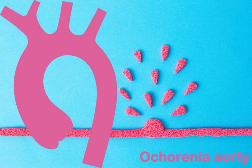 Choroby aorty: tętniak, rozwarstwienie i inne? Poznaj przyczyny, objawy