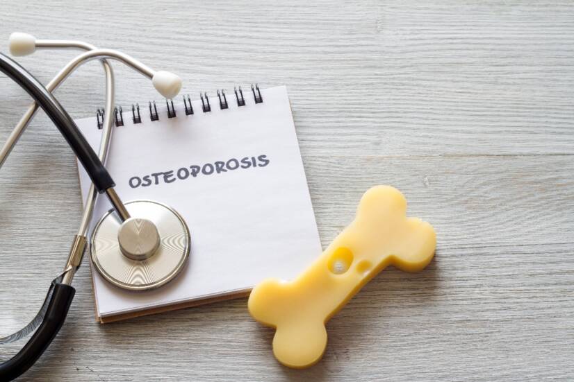 OSTEOPOROZA: Gdy kości słabną, a leczenie jest trudne. Jakie są przyczyny, objawy i konsekwencje + wskazówki dotyczące zapobiegania?