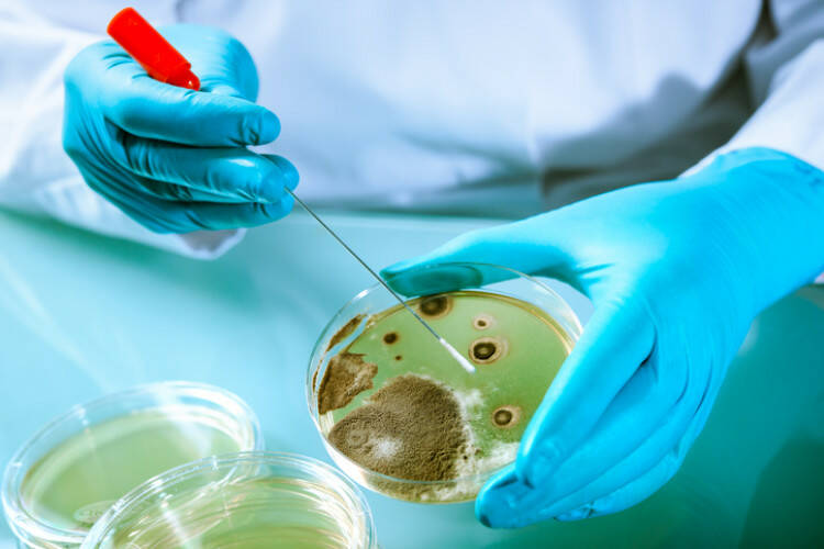 Listeria i skażona żywność: dlaczego występuje i jak się objawia?