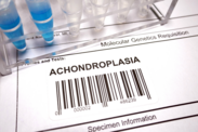Achondroplazja: Jakie są przyczyny i objawy wrodzonej choroby kości?