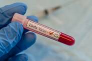 Ebola: Jakie są objawy?