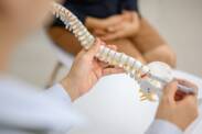 Spondyloza: Czym są narośla na kręgosłupie i dlaczego występują? + objawy
